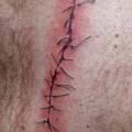 Chest Scar tattoo by Aero & inkeaters